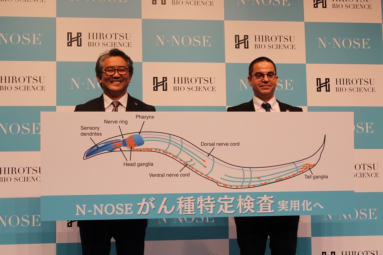 膵臓がんの発見早期に 線虫使った尿検査を開発 HIROTSUバイオサイエンス